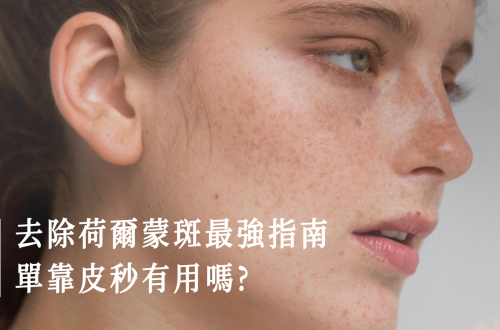 荷爾蒙斑攻略