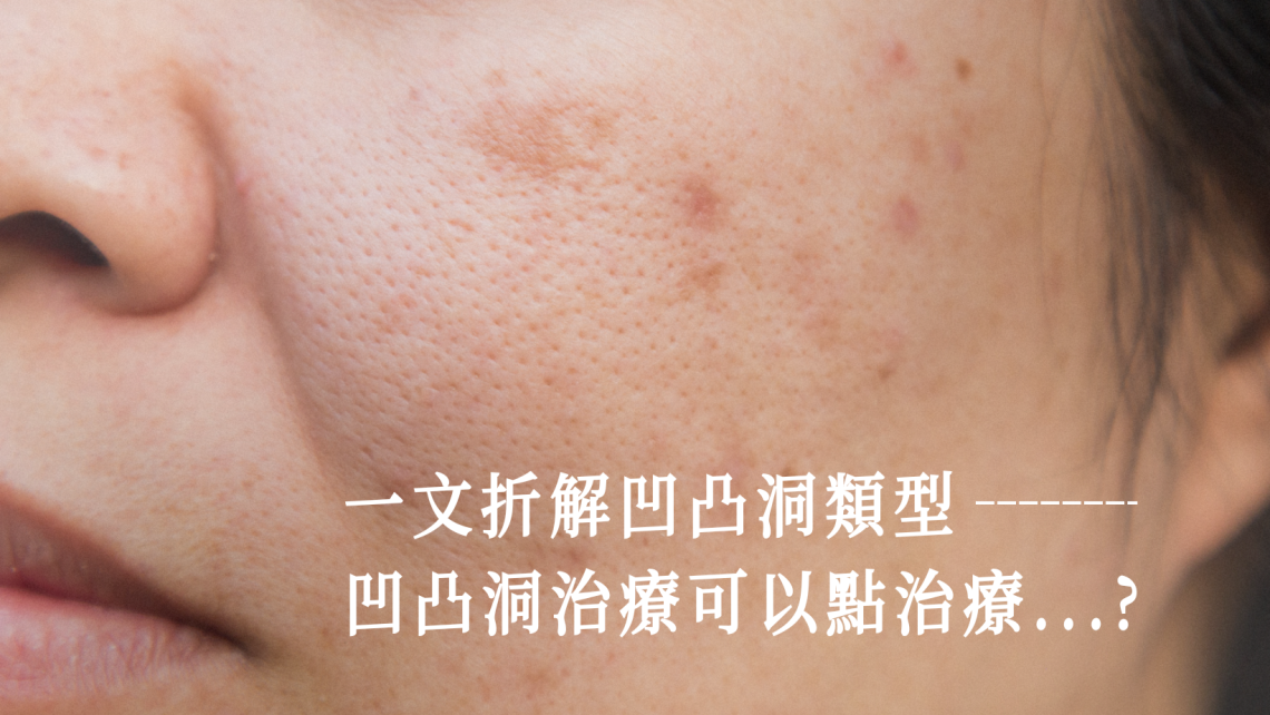 凹凸洞