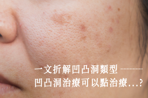 凹凸洞