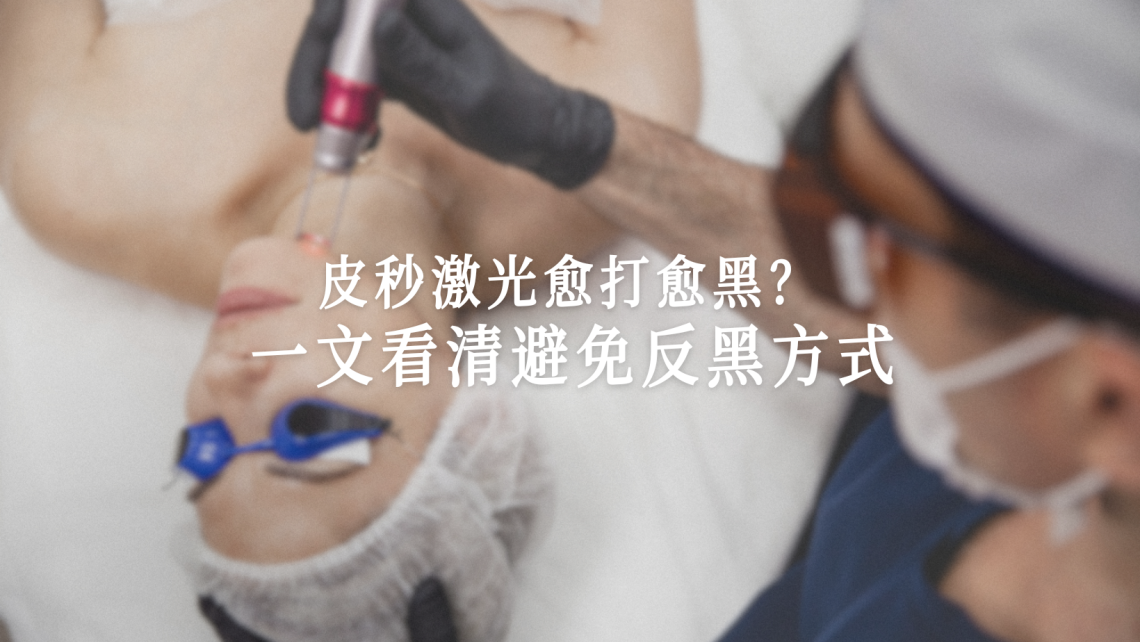 皮秒激光反黑