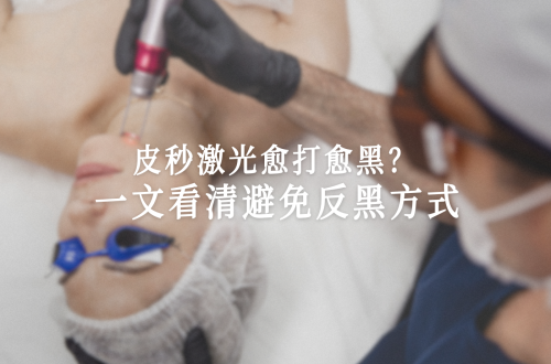 皮秒激光反黑