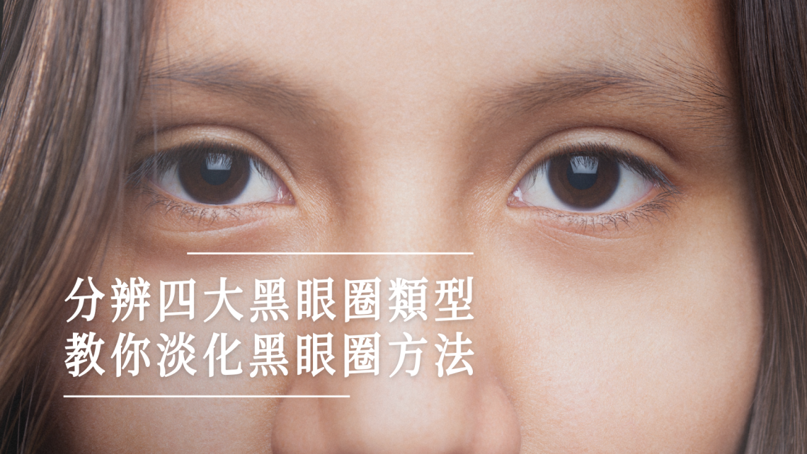 分辨四大黑眼圈類型