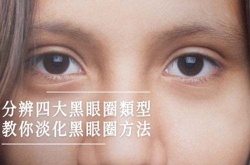 分辨四大黑眼圈類型