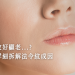 法令紋
