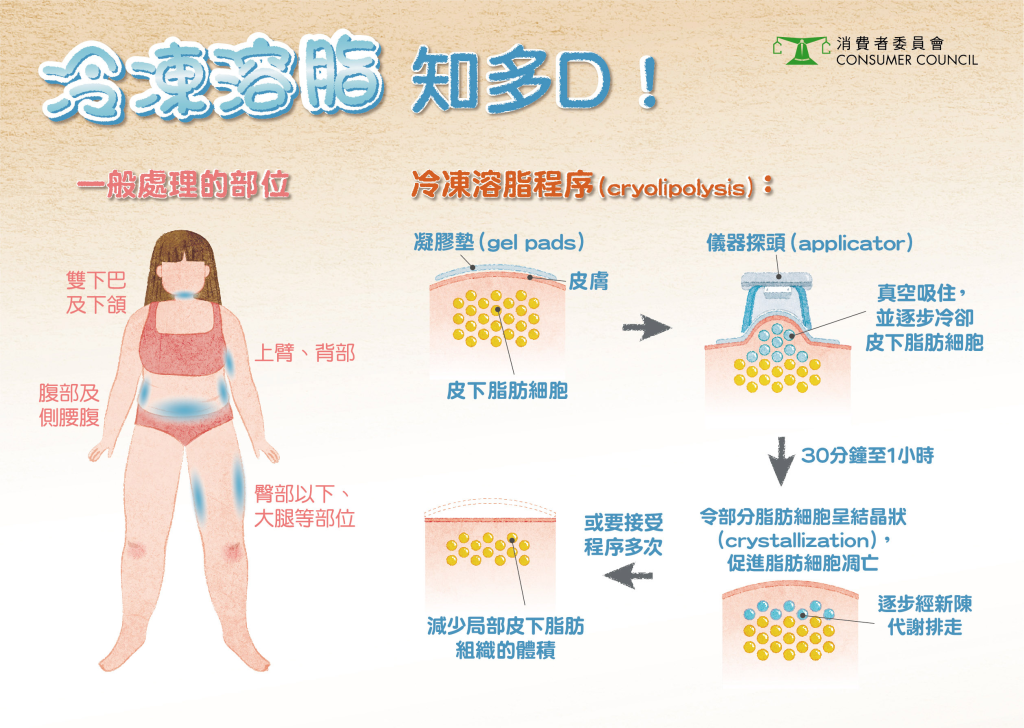 冷凍溶脂
