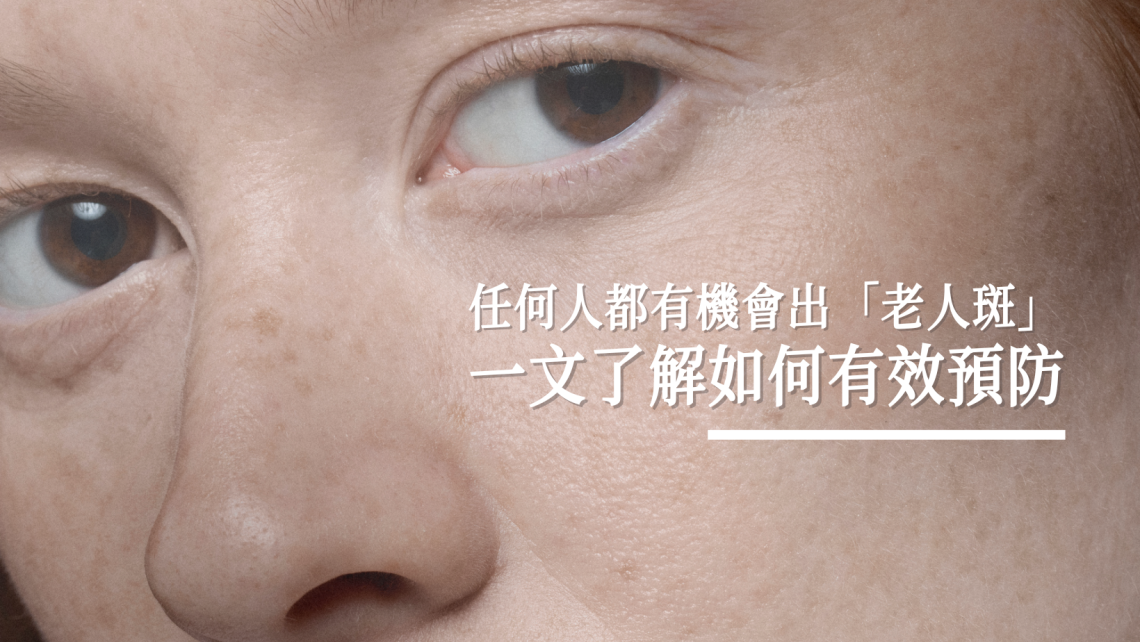 預防老人斑