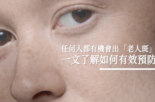 預防老人斑