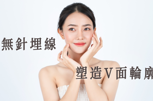 無針埋線2023