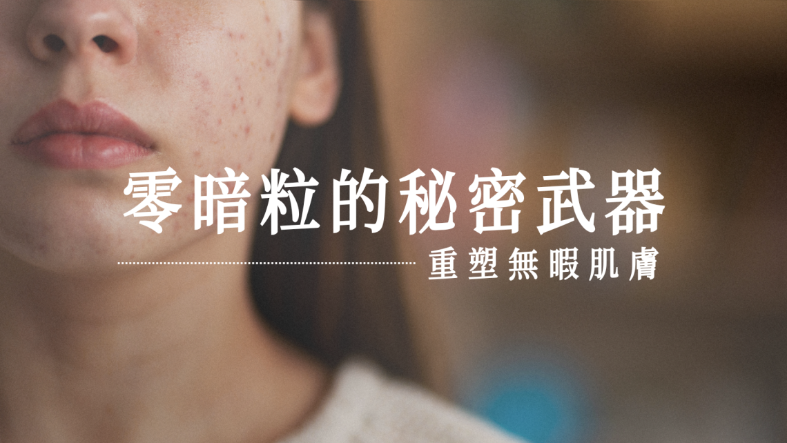 暗粒問題