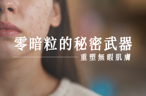 暗粒問題