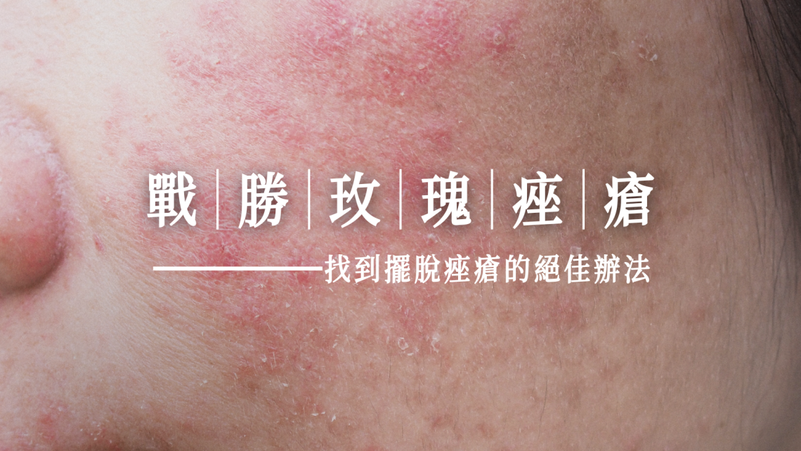 玫瑰痤瘡