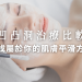 凹凸洞治療