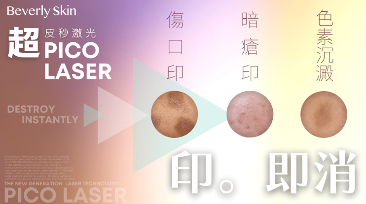 皮秒激光
