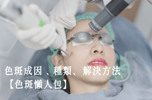 色斑預防方法