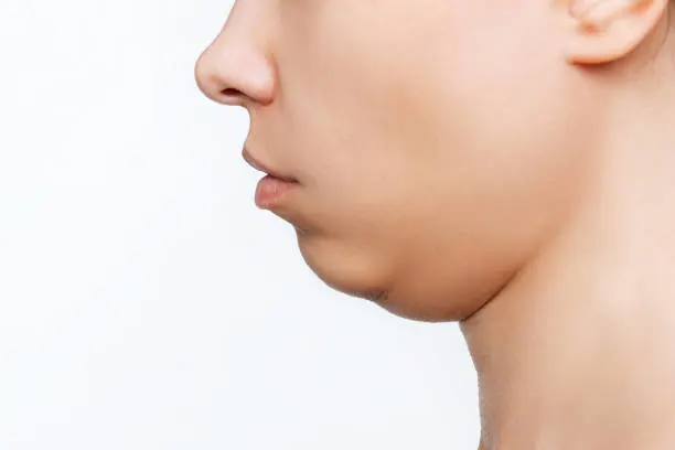 下巴