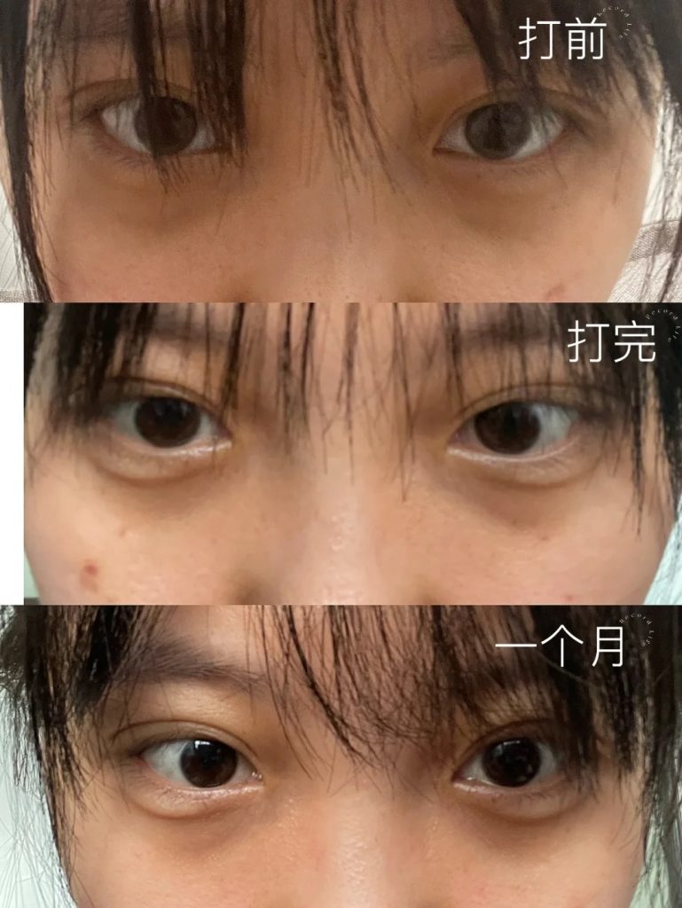 熊貓針失敗