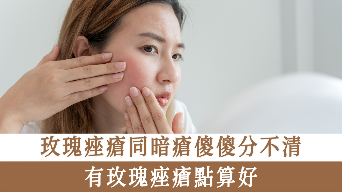 玫瑰痤瘡