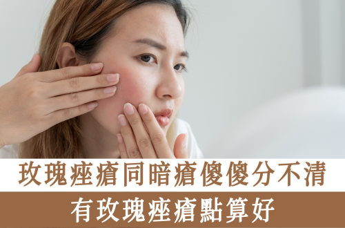 玫瑰痤瘡