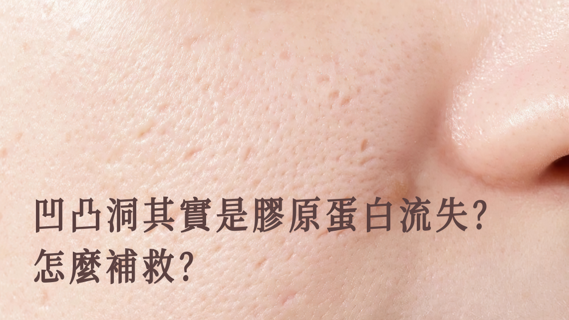 凹凸洞其實是膠原蛋白流失？怎麼才能補救？