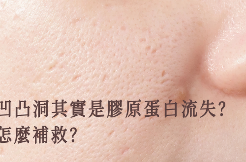 凹凸洞其實是膠原蛋白流失？怎麼才能補救？