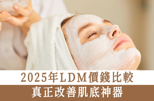LDM
