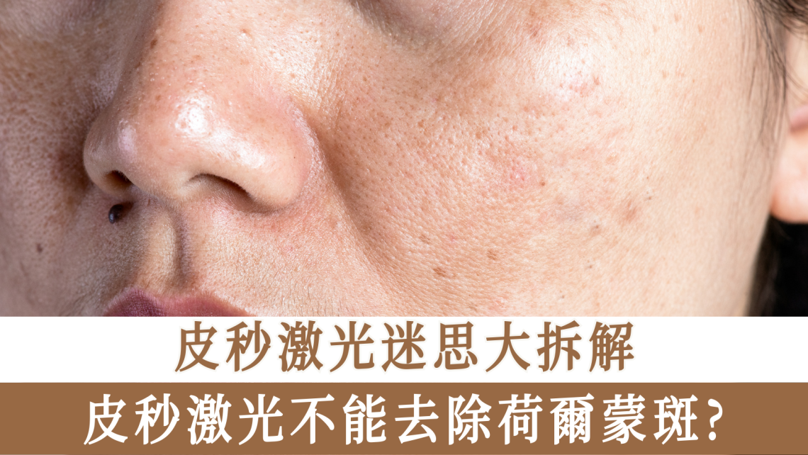 皮秒激光