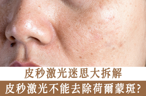 皮秒激光
