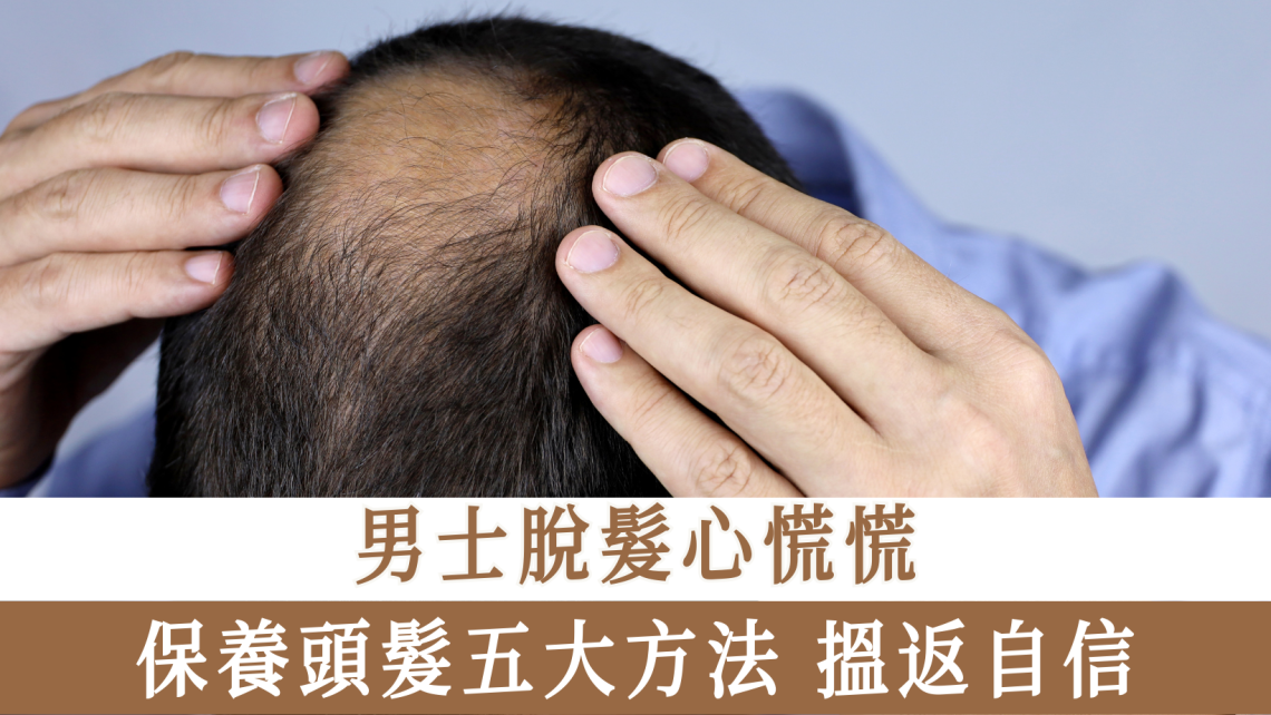 男士脫髮