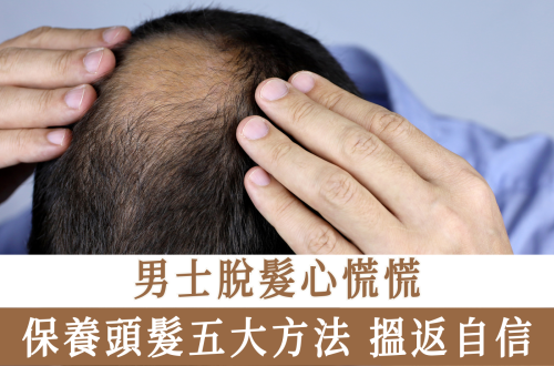 男士脫髮