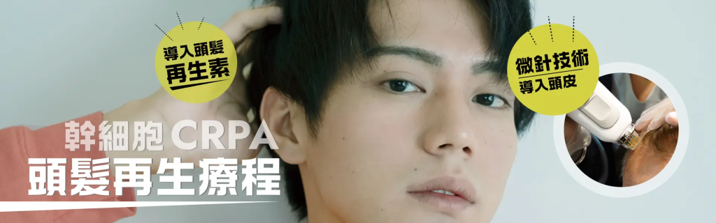 治療脫髮方案