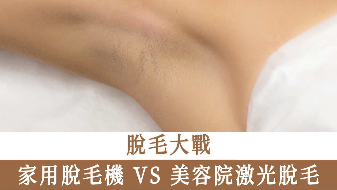 家用脫毛機 VS 美容院激光脫毛