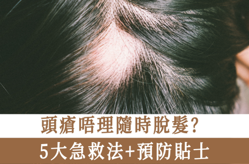 頭瘡唔理隨時脫髮？