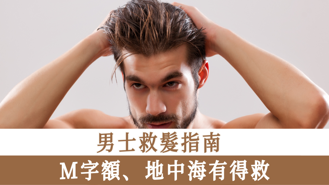 男士救髮指南
