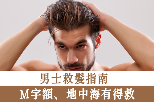 男士救髮指南