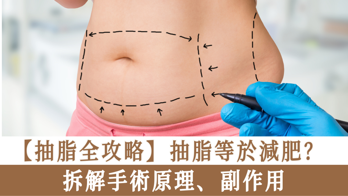 抽脂全攻略