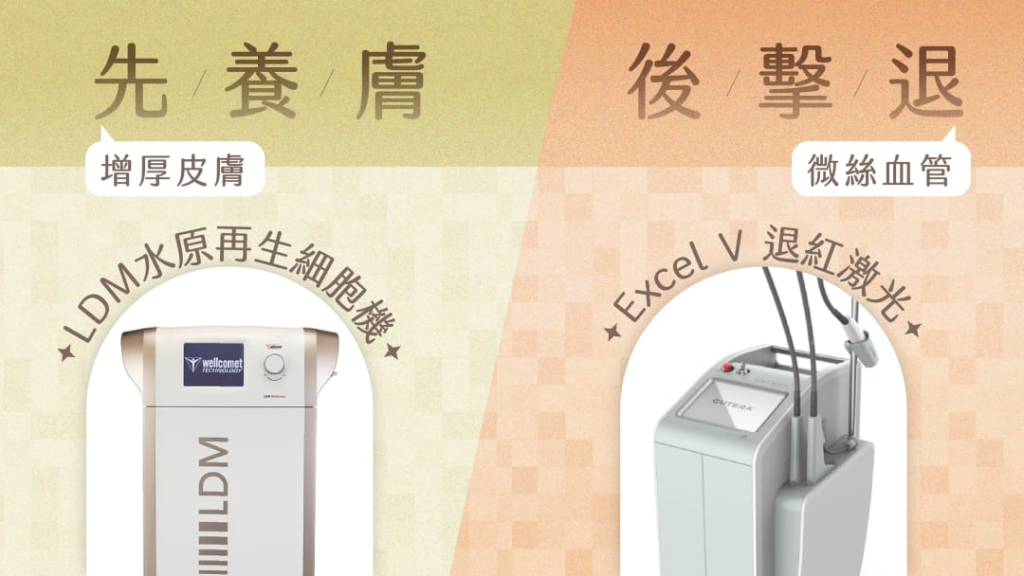 Excel V激光夾LDM水原再生