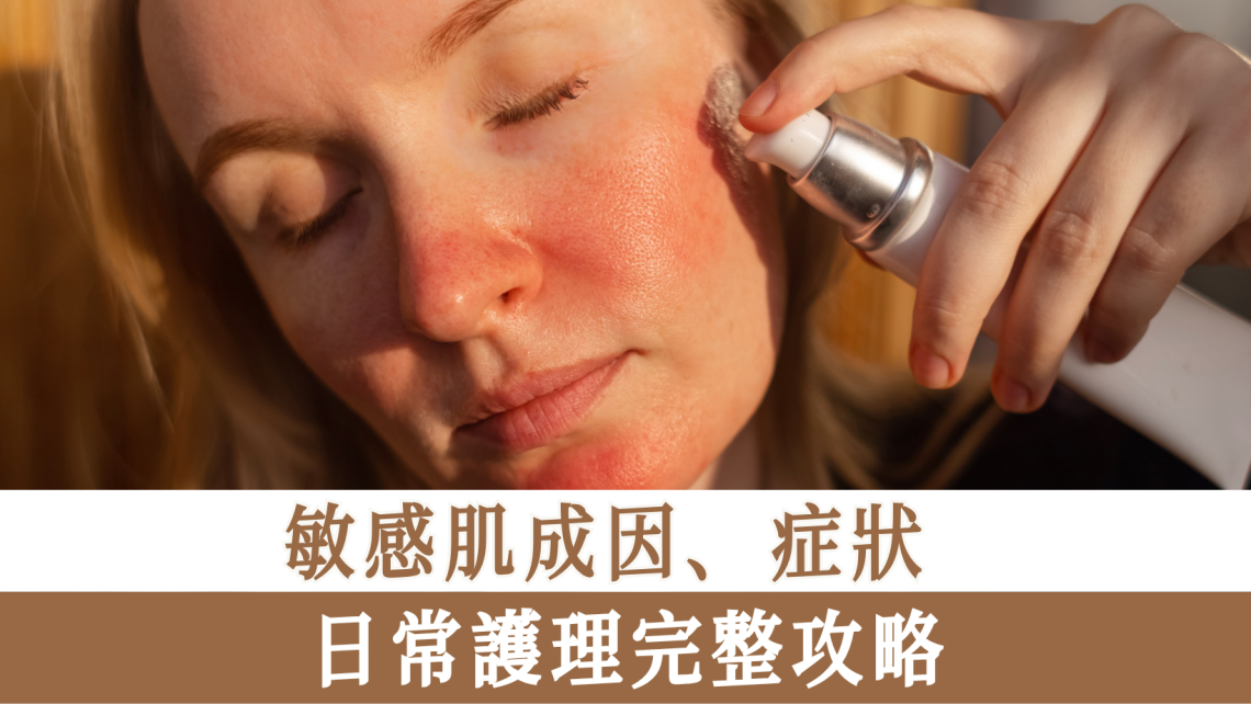 敏感肌成因、症狀、日常護理