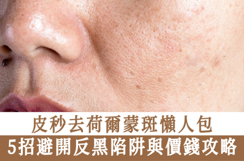 皮秒去荷爾蒙斑懶人包