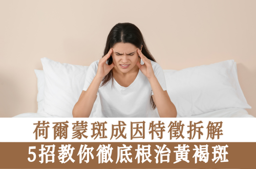 荷爾蒙斑成因特徵拆解